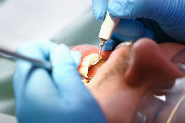Best Knocked-Out Tooth Emergency  in Oak Forest, IL